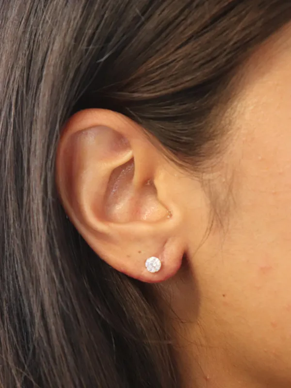 procedure after