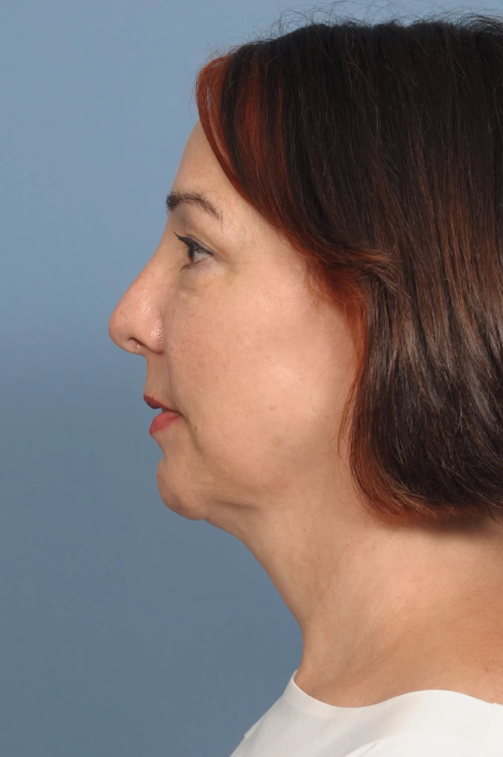 procedure after