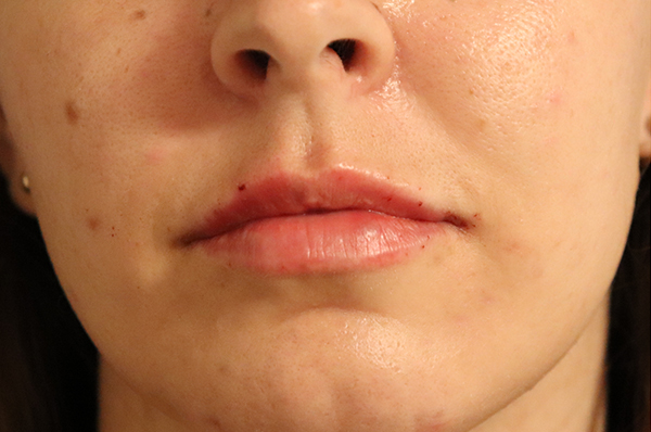 After A