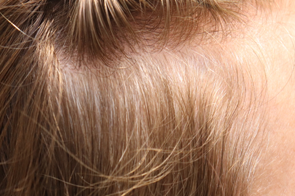 procedure after