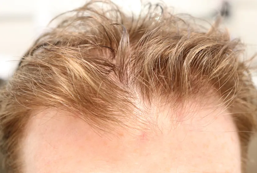 procedure before