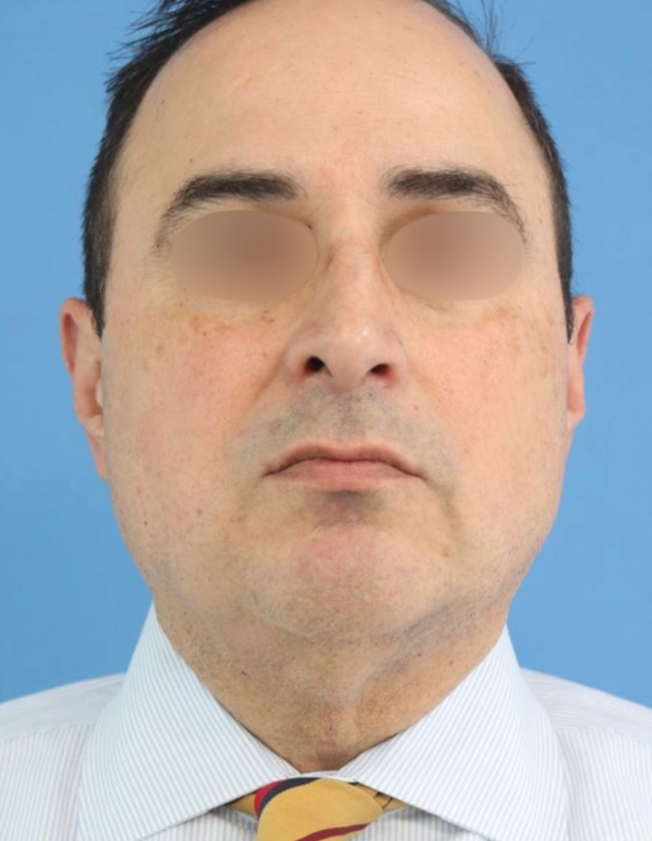 After C